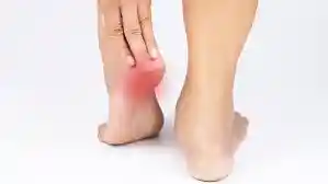 Home Remedies For Heel Pain in hindi..